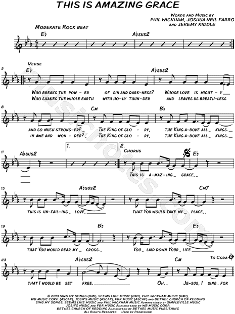 This Is Amazing Grace